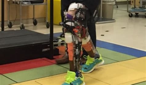 Nih Develops Robot Exoskeleton For Cerebral Palsy Patients Washington