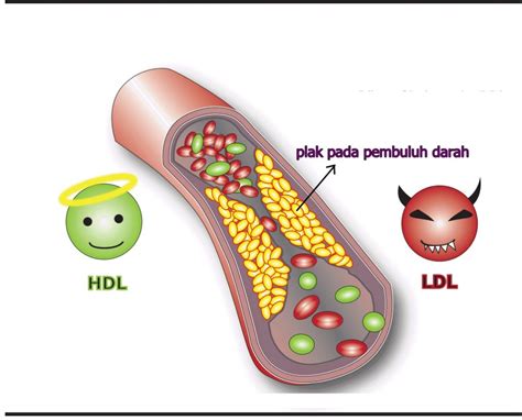 Bahaya Kolesterol Jahat RanaHerbal