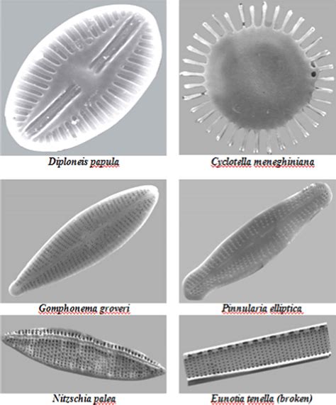 Diatoms Under A Microscope