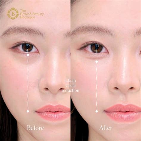 Aegyo-Sal Shading Singapore | Korean Under Eye Shading | Youthful Eye