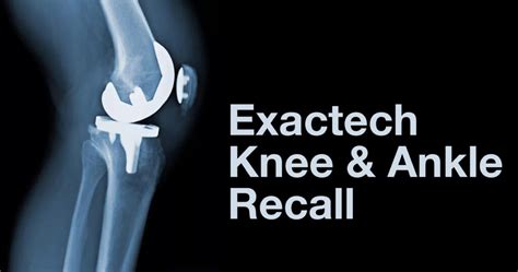 Exactech Knee And Ankle Recall