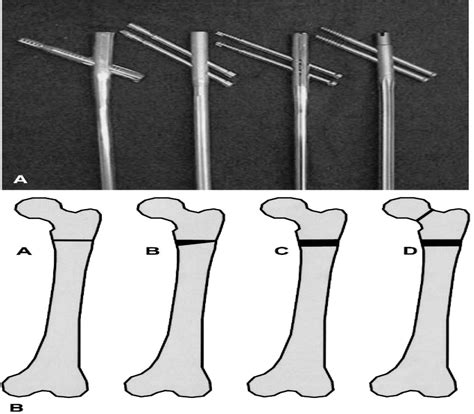 Journal of Orthopaedic Trauma