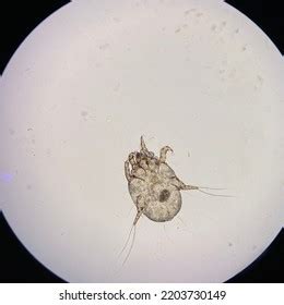 Otodectes Cynotis Ear Mites Under Microscope Stock Photo 2203730149 ...