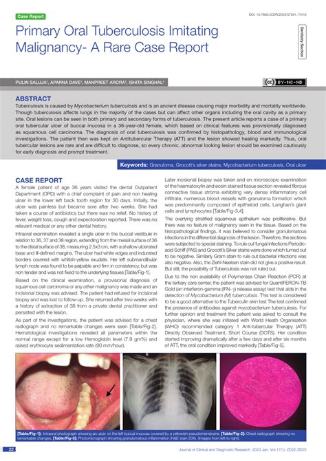 Pdf Primary Oral Tuberculosis Imitating Malignancy A Rare Case Report