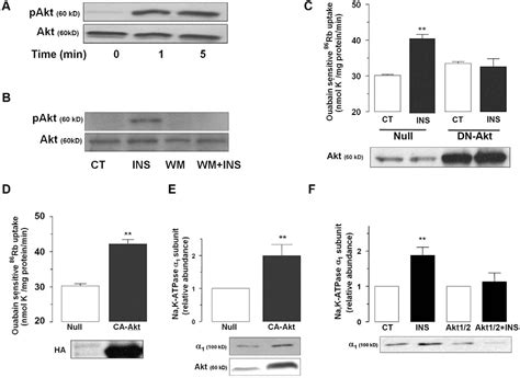 Figure 1 From Insulin Regulates Alveolar Epithelial Function By