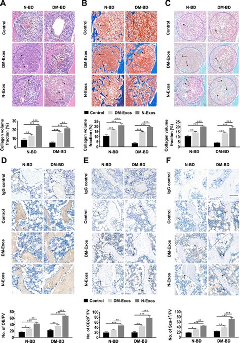 Histological Immunohistological Analysis Of Bone Formation After