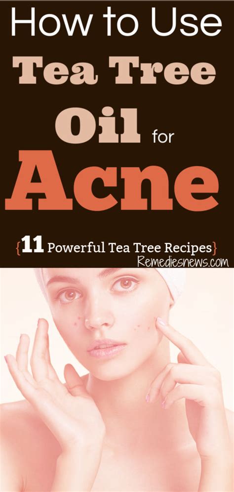 How to Use Tea Tree Oil for Acne : 11 Powerful Tea Tree Oil Recipes