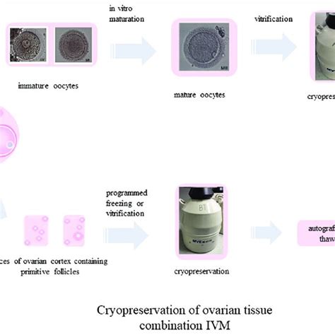 Cryopreservation Of Ovarian Tissue Combined With In Vitro Maturation