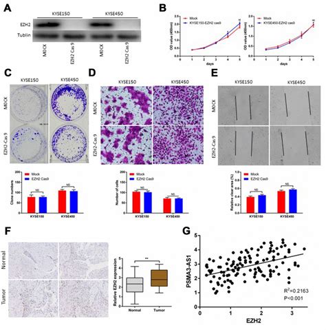 Long Non Coding Rna Psma As Promotes Malignant Phenotypes Of