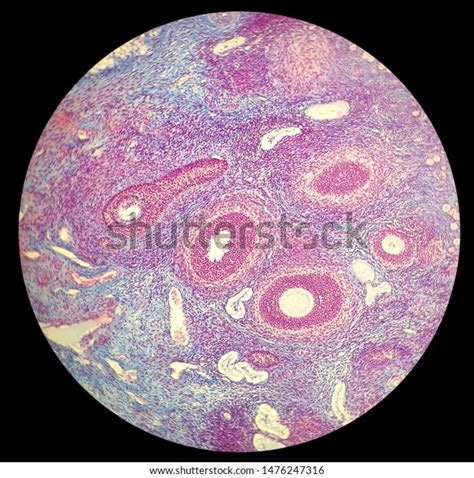 Histology Cells Follicle Ovary Microscope Stock Photo 1476247316 | Shutterstock