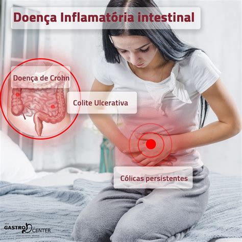 Doen A Inflamat Ria Intestinal O Que Sintomas Causas E Tratamento