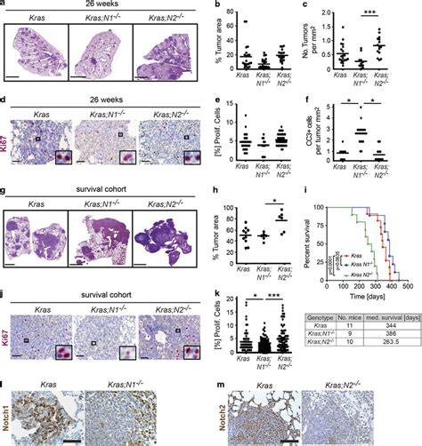 Distinct Role Of Notch1 And Notch2 In Kras Driven Lung Adenocarcinoma