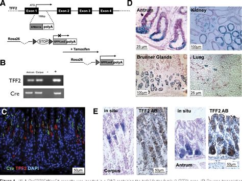 Figure 1 From Tff2 Mrna Transcript Expression Marks A Gland Progenitor