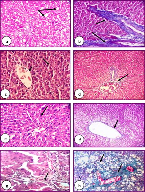 Photomicrographs Of Hande And Massons Trichrome Stained Liver Sections Download Scientific