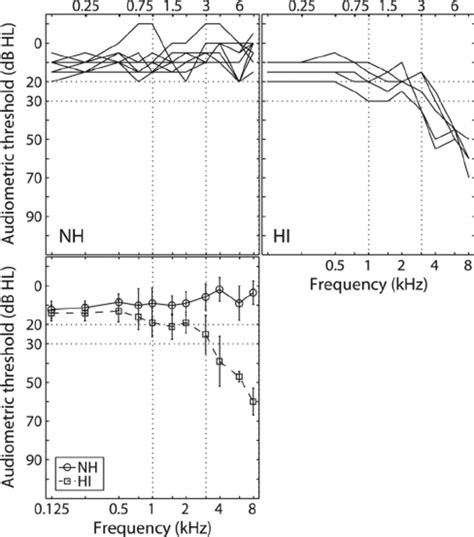 Individual Air Conduction Thresholds Of The Test Ears Of The Nh And Hi Download Scientific