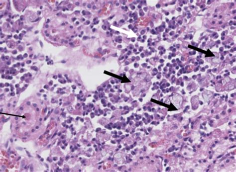 Endocrine Histopathology Flashcards Quizlet