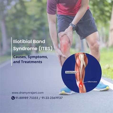 Iliotibial Band Syndrome ITBS Causes Symptoms And Treatments