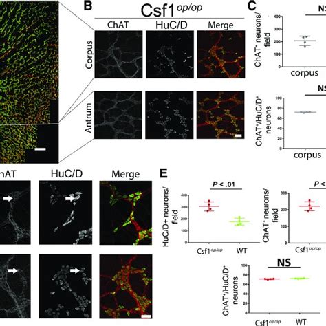 A Distribution Of Huc D D And Chat D Myenteric Neurons Across Gastric