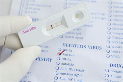 Hepatitis C Causes Symptoms And Treatment Spunout