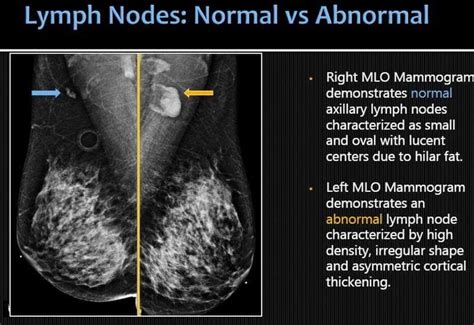 Pin by Carlos A Sanchez on Radiología de Mama | Radiology imaging ...