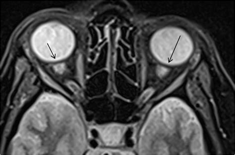 Radiodiagnosis Image Collection January 2014