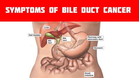 Acclimatize yourself with the symptoms of Bile duct cancer