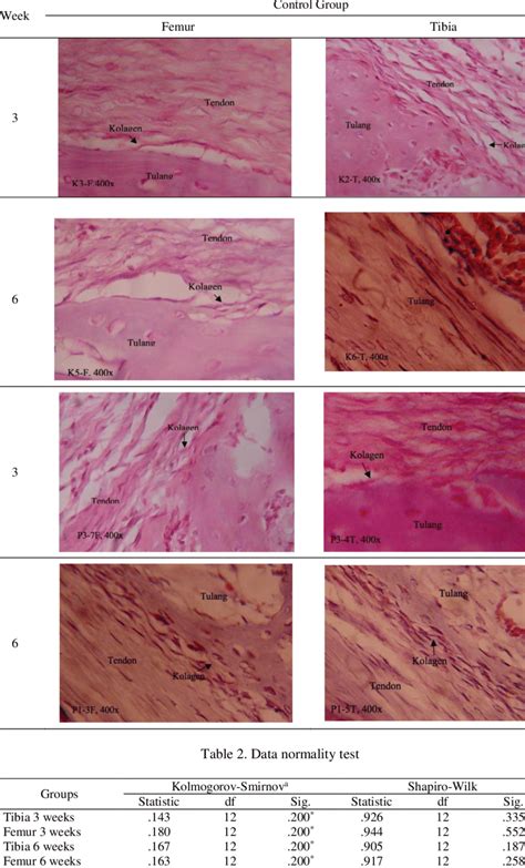 Sharpeys Fibers Histology