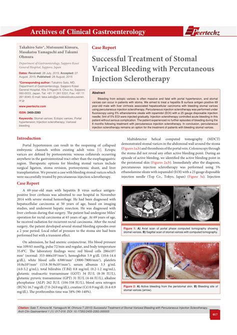 PDF Successful Treatment Of Stomal Variceal Bleeding With