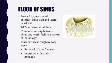 Surgical anatomy of maxillary sinus | PPT