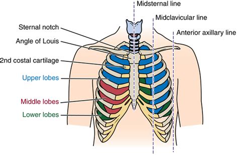 Thoracic Surgery Basicmedical Key