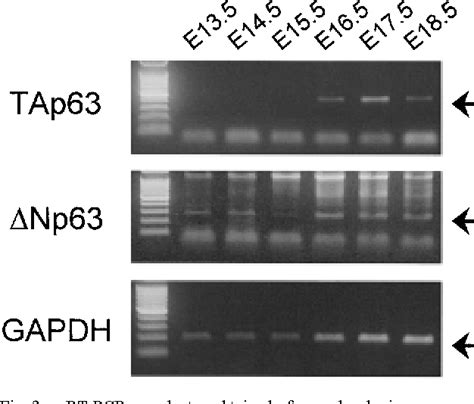 Figure From Expression Of P In The Testis Of Mouse Embryos