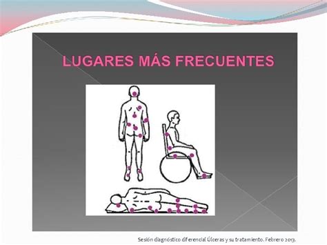 Diagnstico Diferencial De Las Lceras Y Su Tratamiento