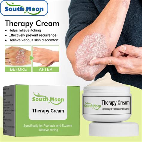 South Moon Psoriasis And Eczema Therapy Cream Itching Relief Antibacterial Dermatitis Anti Itch