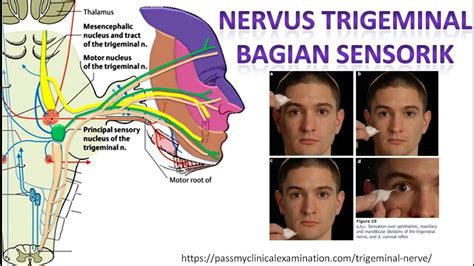 Nervus Trigeminus Adalah Ujian