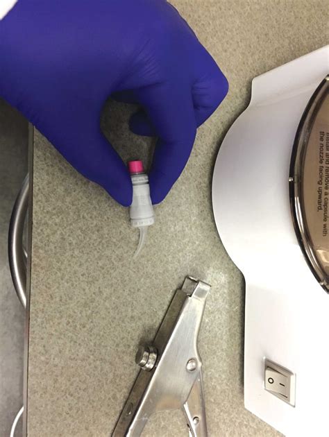 Glass Ionomer Cement Sealants By Dr Jeanette Maclean Dentaltown