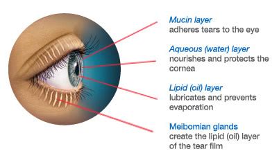 Meibomian Gland Dysfunction - Eye Care Surgery Center