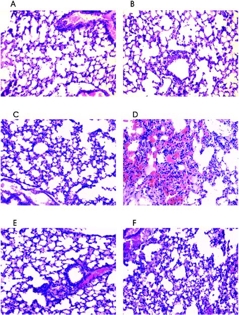 Lung Histopathological Manifestations Of The Lung Tissues At H In