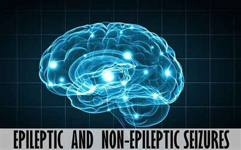 Epileptic Seizures & Non-Epileptic Seizures- Health Tips