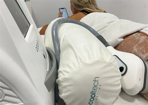 Cooltech Define Cryolipolysis Device Sinclair Global