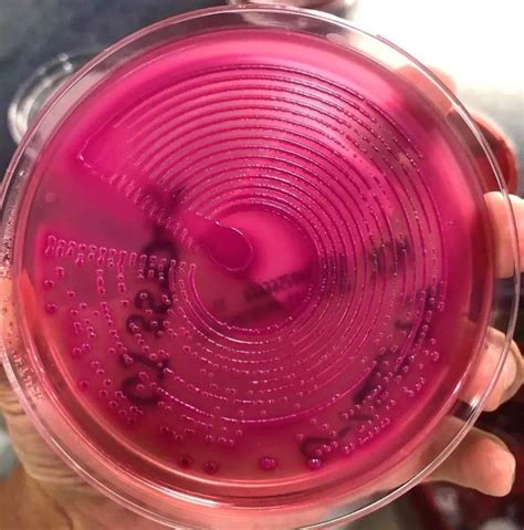 Microbio On Twitter Escherichia Coli En Agar Macconkey Urocultivo