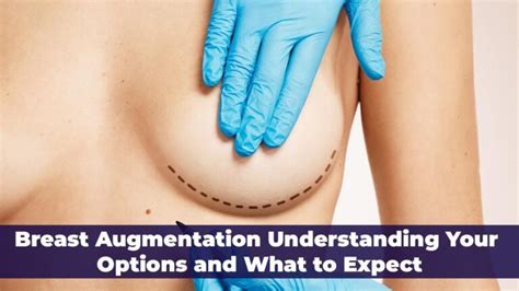 Breast Augmentation In Turkey Your Options And Needs