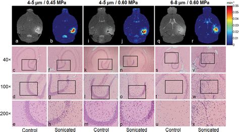 Permeability Dependence Study Of The Focused Ultrasound Induced Blood