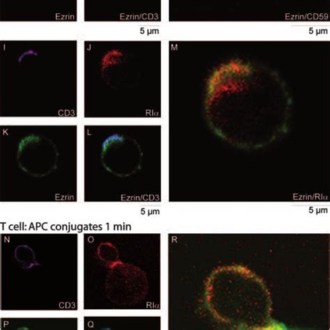 Colocalization Of Ezrin Pka Ri And The Lipid Raft Marker Cd In