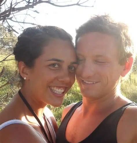 Viral Strange Turia Pitt Got Married Despite Her Disfigurement From