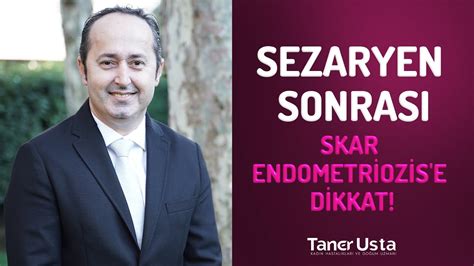 Sezaryen Sonrası Skar Endometriozis e Dikkat Prof Dr Taner Usta