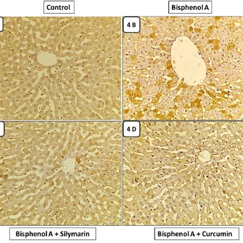 Photomicrographs Of M Trichrome Stained Liver Sections For The Download Scientific Diagram