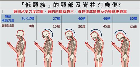 土豆仁體態平衡工房 健康微調整 頸椎 椎間盤突出 的失衡