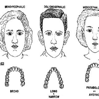 (PDF) Assessment of Palatal Dimensions in a Sample of Iraqi Adults with Different Facial Forms