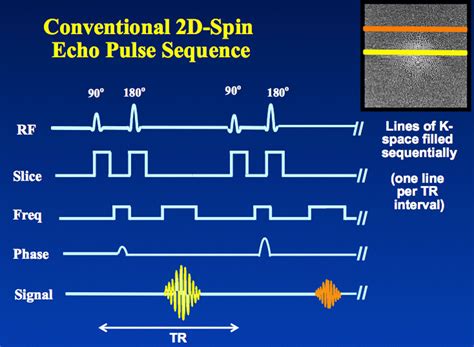 Mri Pulse Sequence Diagram Phase Encoding Phase Contrast Mra