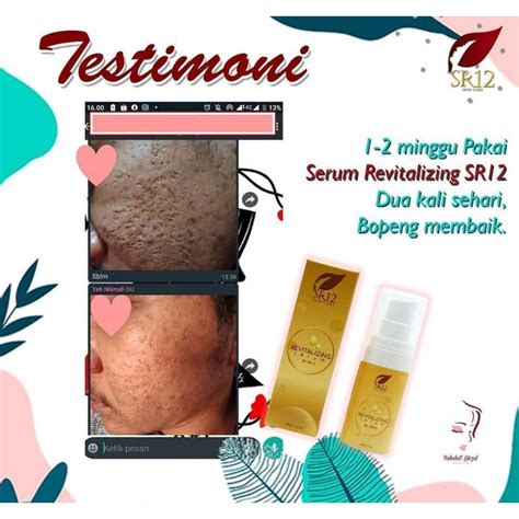 Jual REVITALIZING SERUM SR12 UNTUK MENYAMARKAN BOPENG Shopee Indonesia